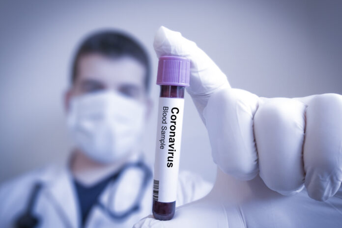 coronavirus